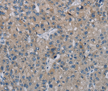 PHKG2 Antibody