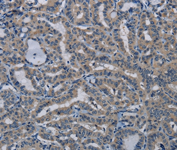 PIK3CB Antibody