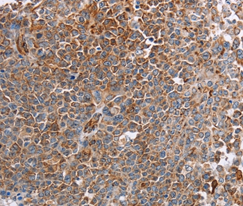 PLXNA2 Antibody