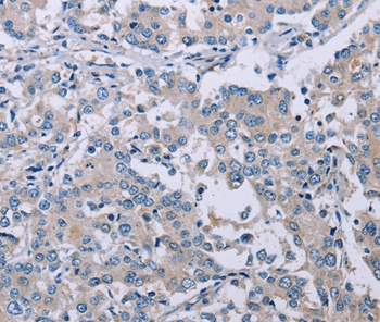 PLXNA2 Antibody