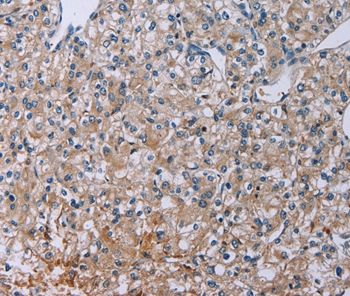 PLXND1 Antibody