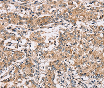 PPP1CC Antibody