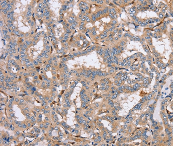 PPM1F Antibody