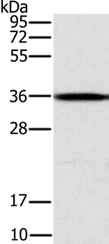 CENPV Antibody