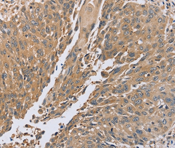 PTPN12 Antibody