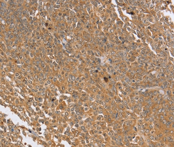 PTPN20B Antibody