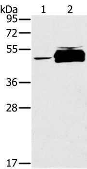 PTPN20B Antibody