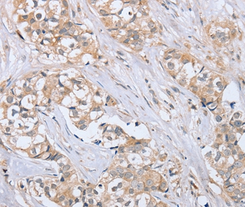 PTPN4 Antibody