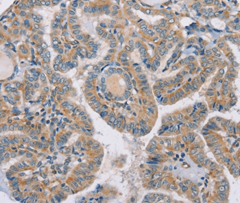 RAB21 Antibody