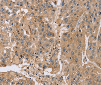 KCNJ15 Antibody