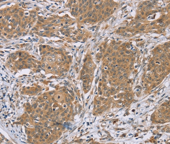 RNF139 Antibody