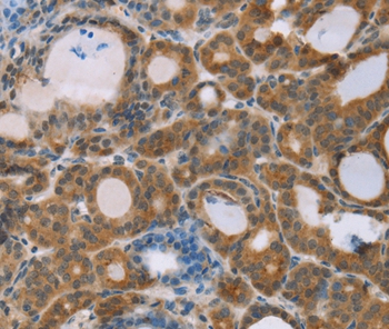 RNF139 Antibody