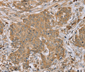 RNF148 Antibody