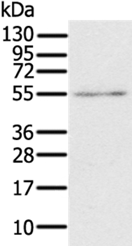 RORB Antibody