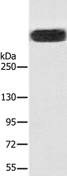 RYR1 Antibody