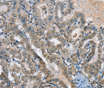 SEPN1 Antibody