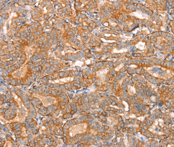 SLC16A11 Antibody