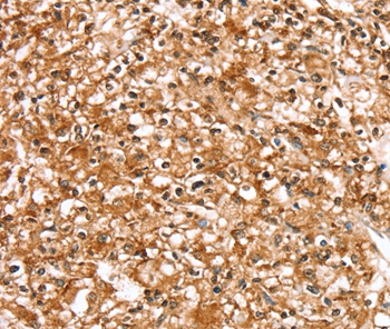 SLC16A12 Antibody