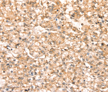 SLC25A38 Antibody