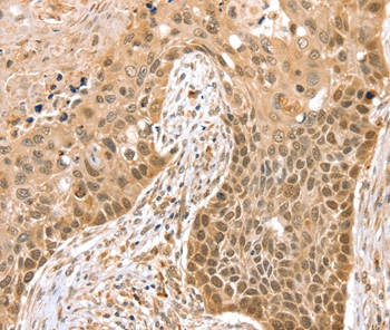 SMARCA2 Antibody