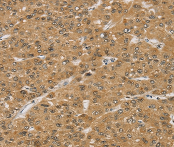 SMC6 Antibody