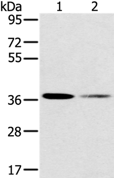 SMN1 Antibody