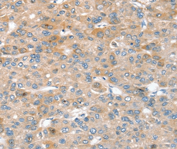 SIK1 Antibody