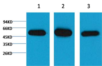 β I tubulin Mouse Monoclonal Antibody