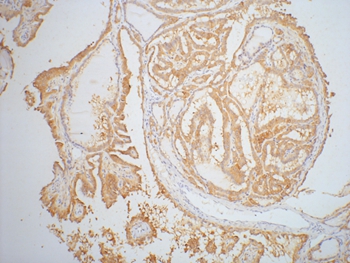 Galectin-3 Mouse Monoclonal Antibody