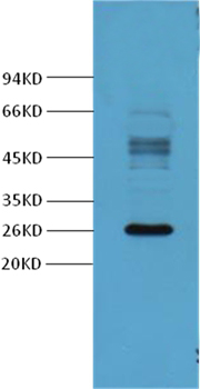 Galectin-3 Mouse Monoclonal Antibody