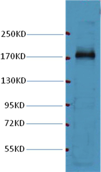 EGFR Mouse Monoclonal Antibody