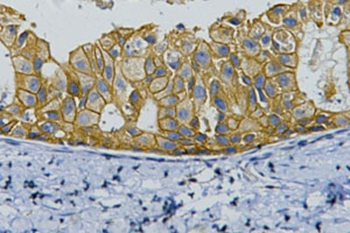 ErbB-2/HER-2 Mouse Monoclonal Antibody