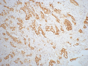 AMACR/P504S Mouse Monoclonal Antibody