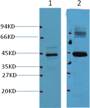 AMACR/P504S Mouse Monoclonal Antibody