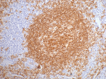 CD20 Mouse Monoclonal Antibody