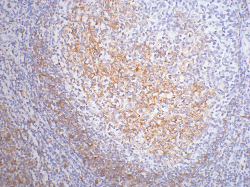 CD23 Mouse Monoclonal Antibody