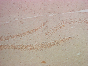 NFκB p65 Mouse Monoclonal Antibody