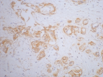 β-Catenin Mouse Monoclonal Antibody