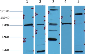 β-Catenin Mouse Monoclonal Antibody