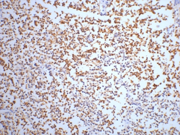 NSE Mouse Monoclonal Antibody