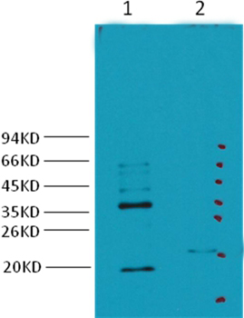 Carbonic Anhydrase IX Mouse Monoclonal Antibody