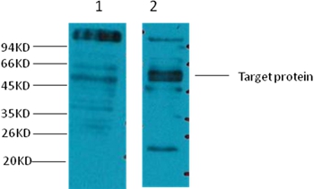 CD23 Mouse Monoclonal Antibody