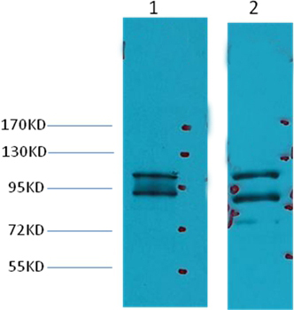 Insulin Degrading Enzyme Mouse Monoclonal Antibody