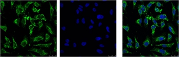 EFHD1 Mouse Monoclonal Antibody