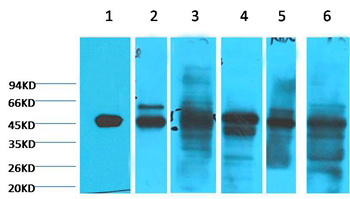 Cytokeratin 18 Mouse Monoclonal Antibody (1B3)