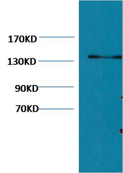 Collagen III Mouse Monoclonal Antibody(Q76)