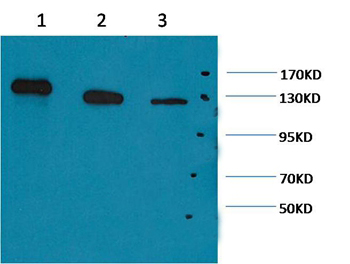 PARP Mouse Monoclonal Antibody