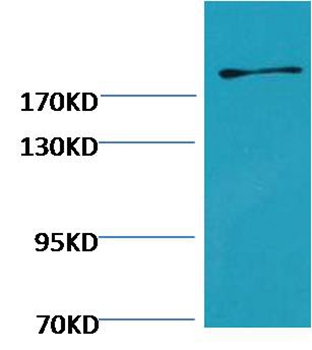 Fibronectin Mouse Monoclonal Antibody