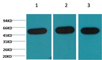 β-tubulin Mouse Monoclonal Antibody