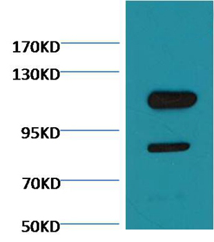 Cleaved PARP Mouse Monoclonal Antibody